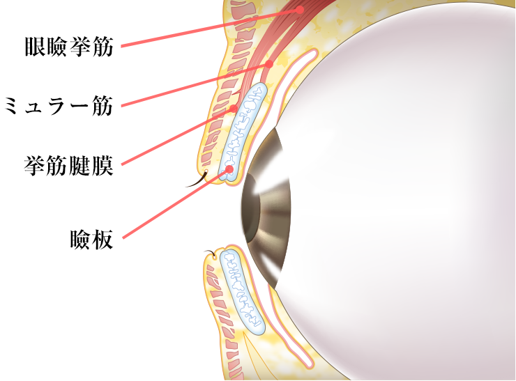 眼瞼下垂の症状
