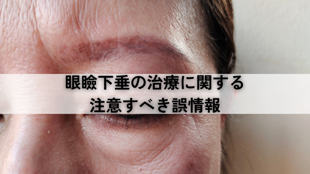 眼瞼下垂の治療に関する注意すべき誤情報