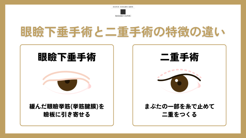 眼瞼下垂手術と二重手術の特徴の違い